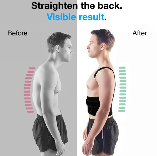 Posture Corrector Belt for Men & Women Improve Spine Alignment & Reduce Back Pain